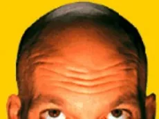 Parte superiore della testa di un uomo calvo su sfondo giallo, simbolo di creatività e idee innovative
